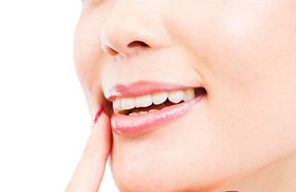 セラミック治療・美しい笑顔